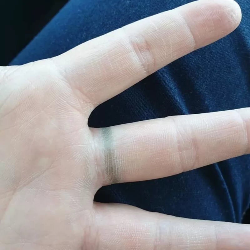 why do rings turn your finger green