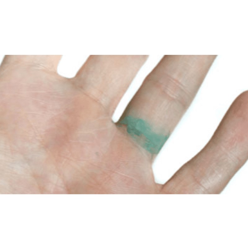why do rings turn your finger green